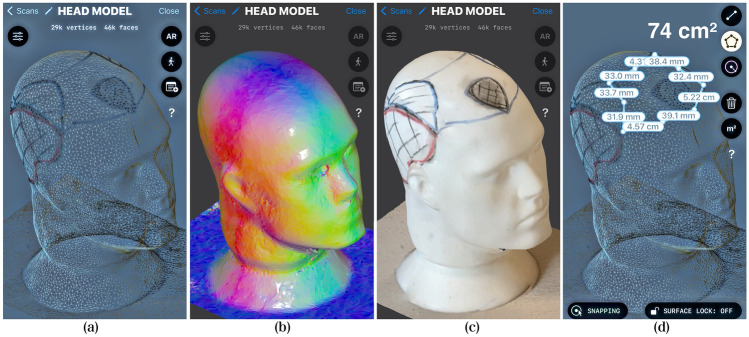 scalp scan stages