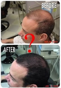 scalp med results