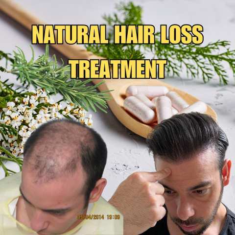 The Best Natural Treatments For Hair Loss