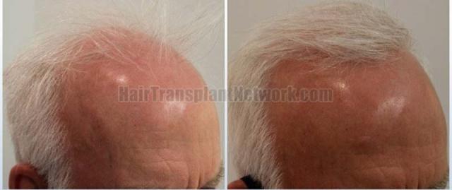 Right view of patient before and after