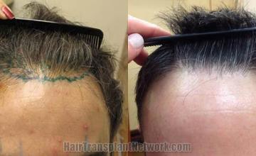 Before and after