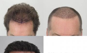 Before and after