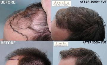 before and after pictures