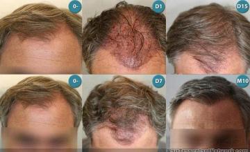 Front View -  results