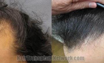 before and after photos
