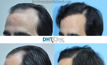 before and after photos