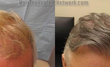 Front view - Before and after