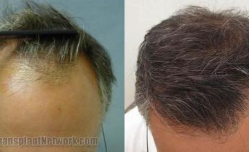 Before and after photos