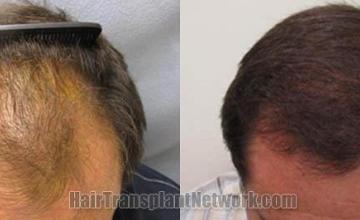 Before and after images