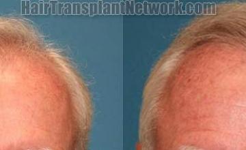 Before and after   photos