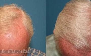 Top view photos displaying  results