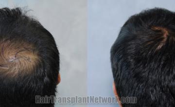  before and after result photographs