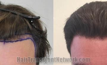 Front view - Before and after