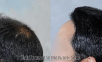 before and after result photographs