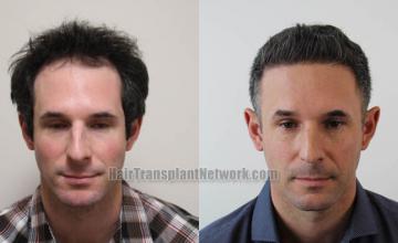 Front view - Before and after