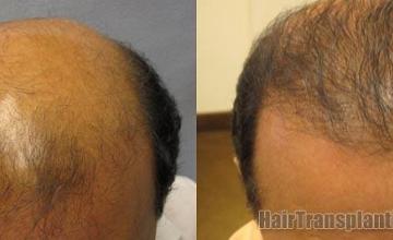 Top view before and after results