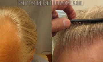 before and after photos