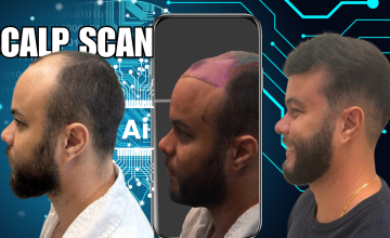 scalp scan ai before and after