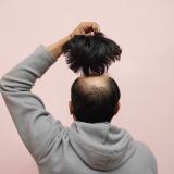 Non Surgical Hair Replacement Systems