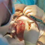 Setting the Highest Standards in Hair Restoration