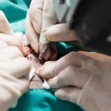 Surgical Hair Restoration - View our procedures in detail