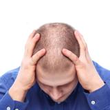 Non Genetic Causes of Hair Loss
