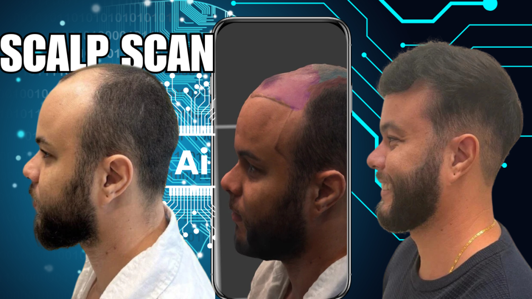 scalp scan ai before and after